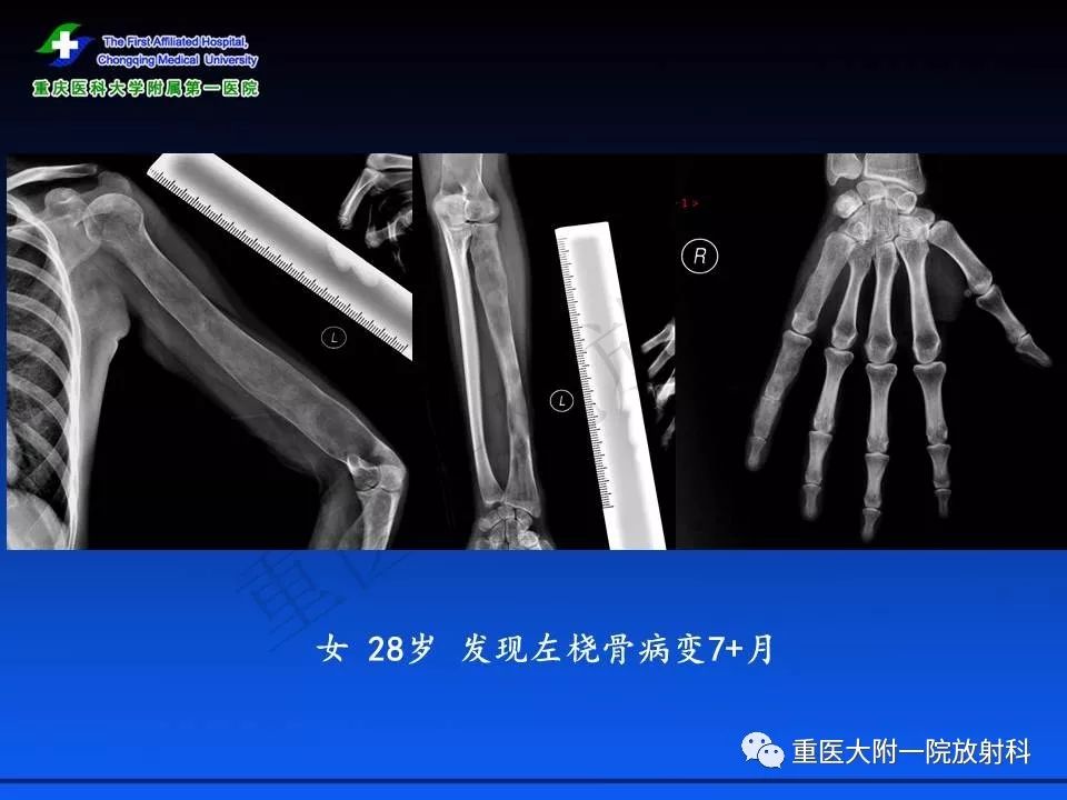 养鬼吃人8:地狱世界